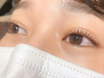 アイドット(i.)/気になっていた左右差も解消