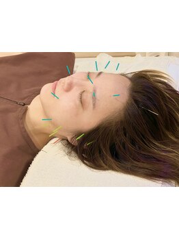 ホウレイ線・たるみ改善！予防ケア