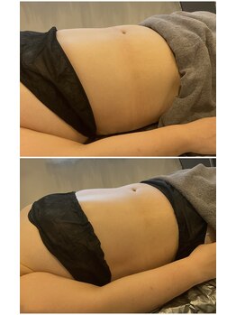 ウル(Ulu)/腸もみビフォーアフター