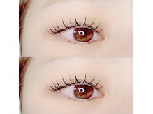 ウィンジュリー(Winjury)/フラットラッシュ