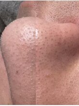 マルク(MARQUE)/毛穴パック