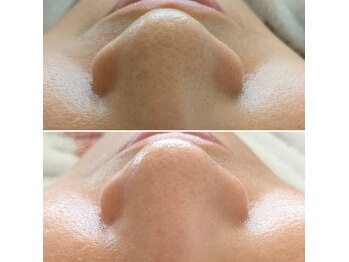 ラ リノ 星ヶ丘(La Lino)