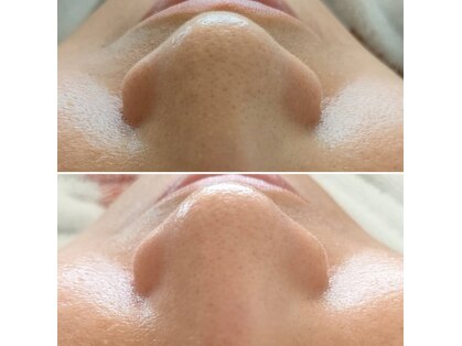 ラ リノ 星ヶ丘(La Lino)の写真