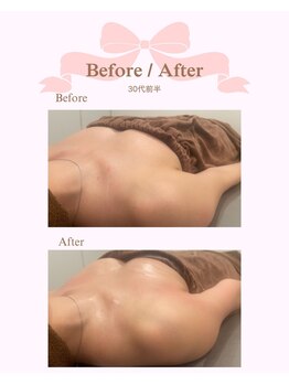 ロココ 安城店(Rococo)/バストアップ症例