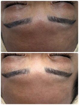 ジュエルビューティー(Jewel Beauty)/リセラアクアヴィーナス