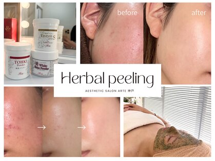 アルテ 神戸(Arte)の写真