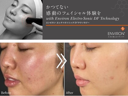 ハルム(HaluM)の写真