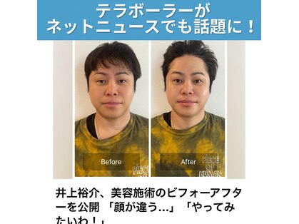 癒える(ielu)の写真