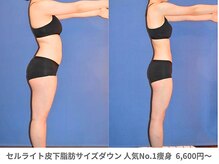 ピュアノア 三木店/痩身　三木/小野/西脇/加東/加西