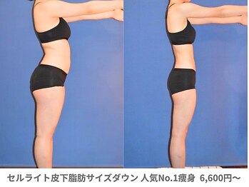 ピュアノア 三木店/痩身　三木/小野/西脇/加東/加西