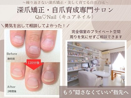 キュアネイル(Qa Nail)の写真