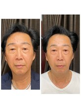 ココスタイルビューティー(COCOSTYLE beauty)/リフティング