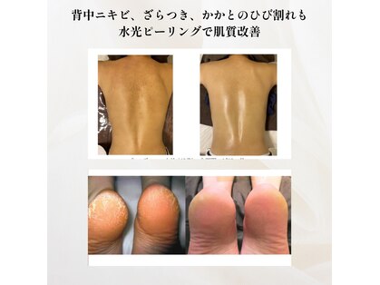 エテル(eter)の写真