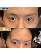 眉毛ハウス 吉祥寺店(眉毛HOUSE)/お客様の施術例(吉祥寺/東京)
