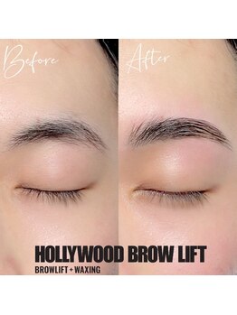 テテ(TeTe)/メンズハリウッドブロウリフト