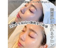 ロッティ アイラッシュ(lotti eyelash)の雰囲気（最新第4世代韓国水光ピーリング韓国女優さんの艶肌になれます！）