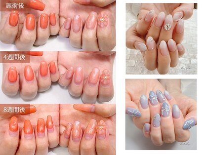 ハリリア(harilia)の写真