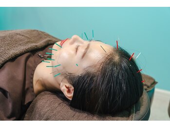 ビアンカ 鍼灸サロン川崎院(Bianca)/美容鍼