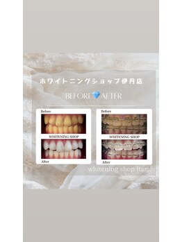 ホワイトニングショップ 阪急伊丹店/ホワイトニングショップ伊丹店