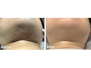 アールイー(Re:)/