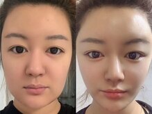 ビビッド(ViViD)/漢方オイル