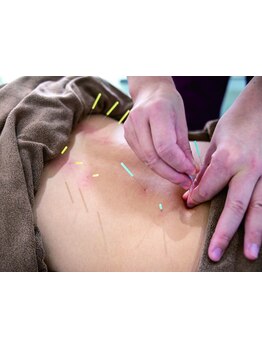 鍼灸施術を受けたい