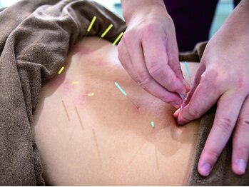 鍼灸整骨院 イーアス(E'as)の写真/【9月NEWOPEN★】国家資格保持,施術歴20年以上!身体のプロがアナタの悩みの根本改善をお手伝いいたします!