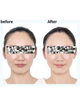 ラグラン銀座メディカルエステ 高輪ゲートウェイ店/大人の肌悩み乾燥・赤み・肌荒れ