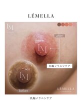 エルビービュティーサロン(LB BEAUTY SALON)/【ルメラ乳輪】実績数関西1★