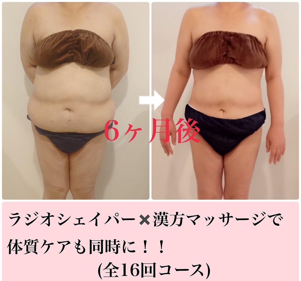 エステティックサロン エポック(epoque)｜ホットペッパービューティー