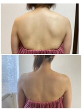 ブリランテ(Brillante)/体験→継続6回目beforeafter