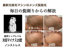 ツインシェリール(Twin cherir)の雰囲気（美肌にもなる最新脱毛機器）