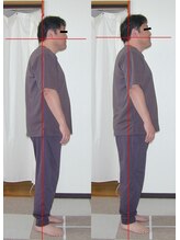 ピュアリー整療院/施術前後（横）