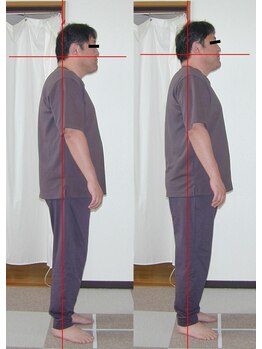 ピュアリー整療院/施術前後（横）