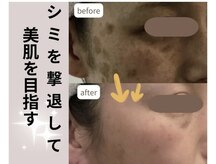 コスメ デ グレース イオンモール宮崎店