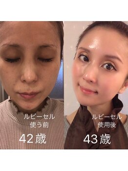 ナナラ(nanala)/オーナー自身のお肌変化