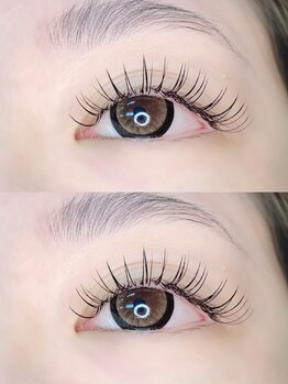 ウィンジュリー(Winjury)/フラットラッシュ