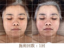 アンスリウム(ansrium)