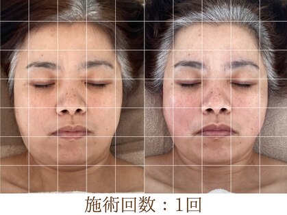 アンスリウム(ansrium)の写真