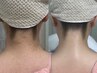 【夏までに自信のもてる肌に…！】うなじそり+うなじ光脱毛　¥7700→ ¥7200