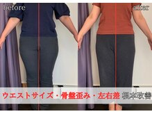 リベスト(RE:BEST)/骨格矯正/ウエスト/骨盤の歪み