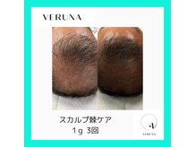 リレア ラカ(Relair Laka)の雰囲気(新メニュ―のスカルプケア!抜毛、フケ、乾燥が気になる方)