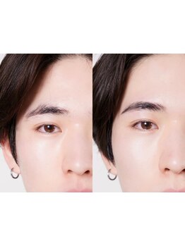 メンズフェイシャル