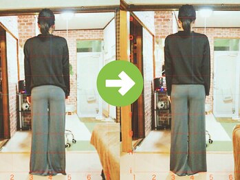 サプライズ整体院/30代ママの初回産後の骨盤矯正