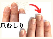 広島深爪専門ネイルサロン ナッカの雰囲気(深爪専門歴11年の技術と知識でケア)