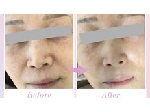 マカナ(Makana)の雰囲気（クリニック導入＊お肌のトラブルを内側から肌質改善します！）