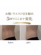 ピーエム(P.M)/むくみコリ改善集中ケア