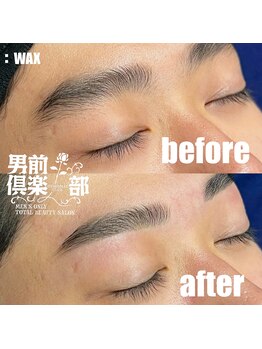 男前倶楽部/脱毛/メンズ脱毛/メンズ専門店