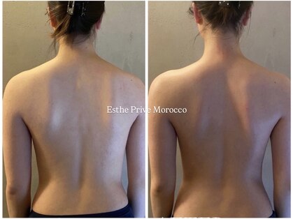 エステプリヴェモロッコ(ESTHE PRIVE MOROCCO)の写真