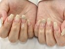 ちゅるるん定額ネイル